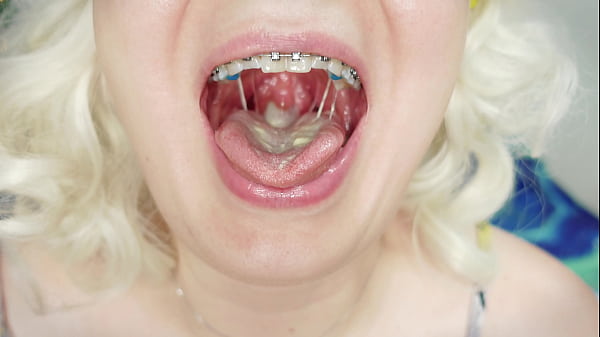 Food Fetish Asmr Video In Braces!. thumbnail