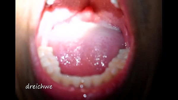 Uvula In The Patio Of My House thumbnail