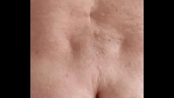 Kalle mit 2 dicken Knubbels die einen Durchmesser von 10cm haben