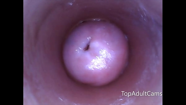 Play MP4 - Endoscope Inside Pussy On Live Cam