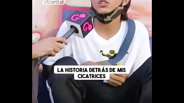 Nonton La Historia Detr&aacute;s De Mis Cicatrices #vertigo #elchicletv #vida #chiclenoticias #patinetas #deporte #atrevidoypegajoso thumbnail