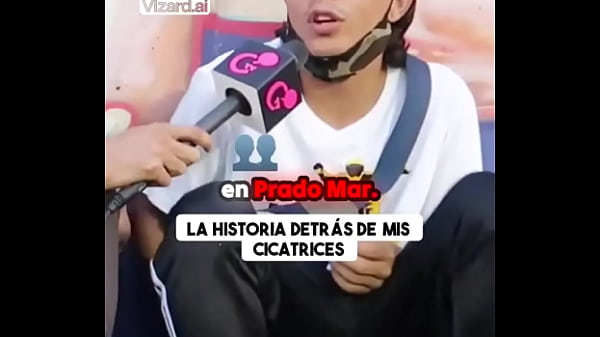 La historia detr&aacute;s de mis cicatrices #vertigo #elchicletv #vida #chiclenoticias #patinetas #deporte #atrevidoypegajoso 