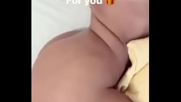 Woman all healed showing hersilicone breasts