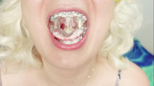 Food Fetish Asmr Video In Braces! thumbnail