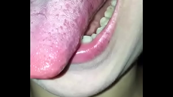 White Tongue Girl thumbnail