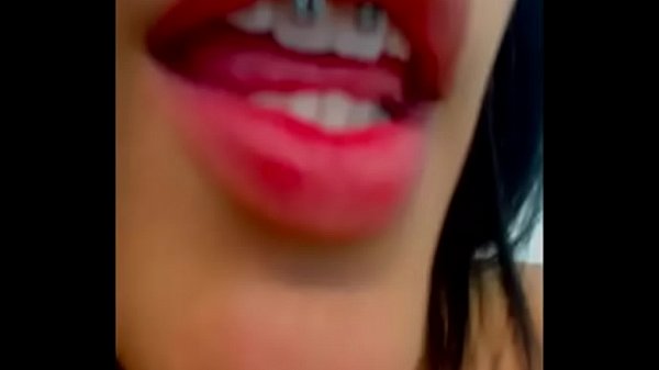 home d20 another beautiful_braces girl