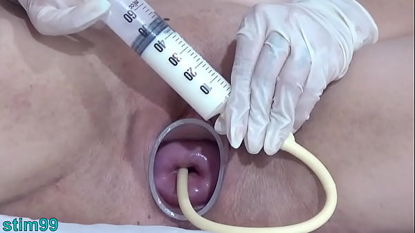Perverse mature enlarge her cervix with penetration of catheter inflated until orgasm