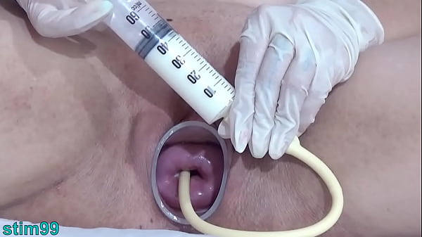 Play MP4 - German Cervix Stretching with Catheter Inflation Uterus
