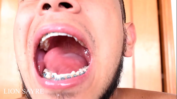 Mouth And Teeth Fetish thumbnail