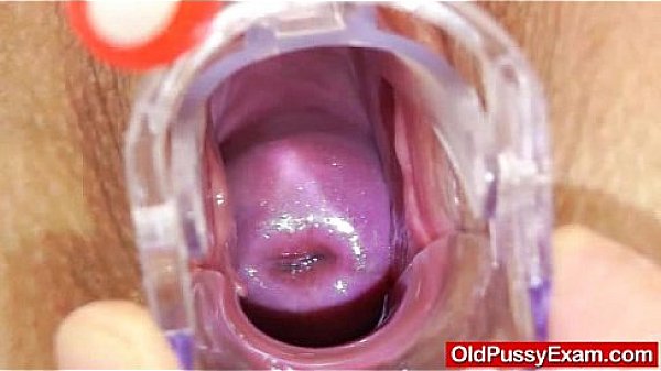 Milf pussy stretched during gyno exam 