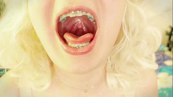 Perfect Asmr Video Great Sound Of Eating With Braces 4k thumbnail