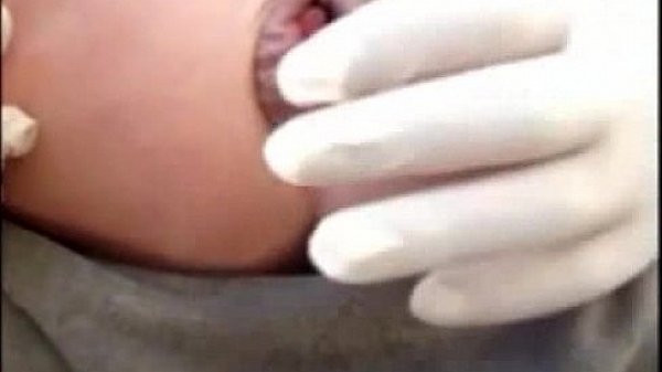 gay ass hole extrem gape 