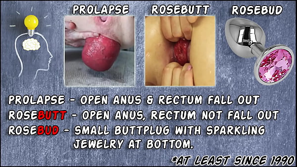 Maria dildo & prolapse 