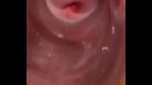 Deep Cervix thumbnail