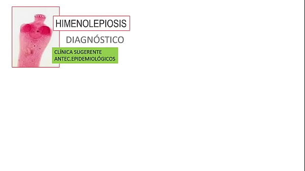 Jugando con el culo de mi novia 