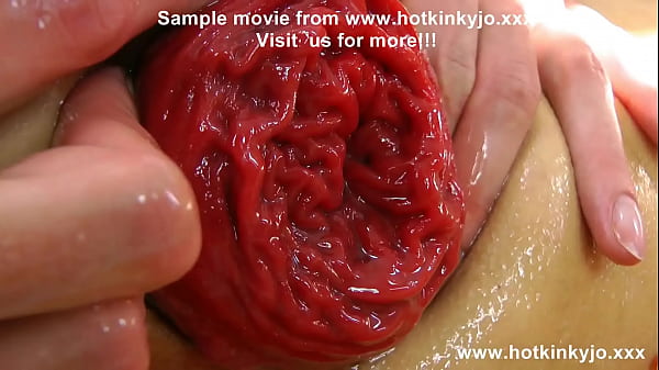 Play MP4 - Hotkinkyjo fill her ass with tons of jellies and prolapse