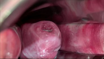 Nonton Masked Whore Extreme Cervix View And Double Vaginal Fisting thumbnail