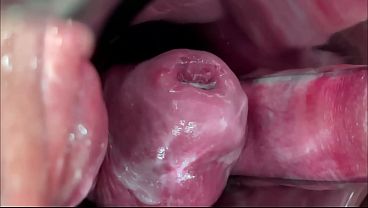 Masked whore extreme cervix view and double vaginal fisting