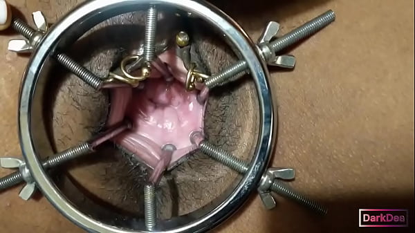 The Kinky Cocks-devourer "dark Dea" In (stretching Cow Speculum & Fist) thumbnail