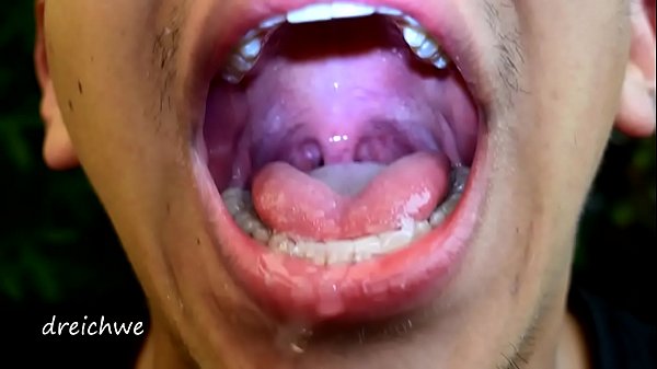 Early Morning Uvula thumbnail