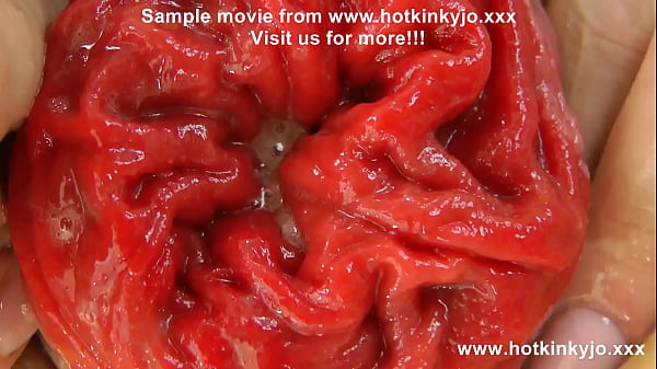 Play MP4 - Black & yellow anal fisting & prolapse extreme