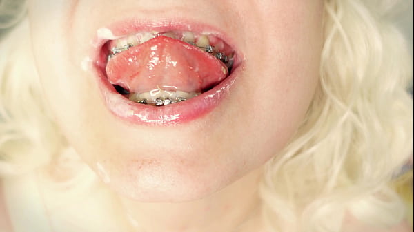 Pretty Cute Asmr Video Great Sound Of Eating With Braces 4k thumbnail