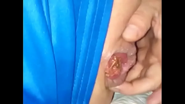 Alain speelt met zijn kont. 