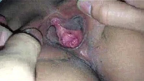 Vid-20160819-wa0027 thumbnail