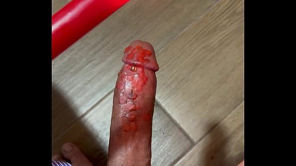 DOLOR CON LUMBRE DE VELA 