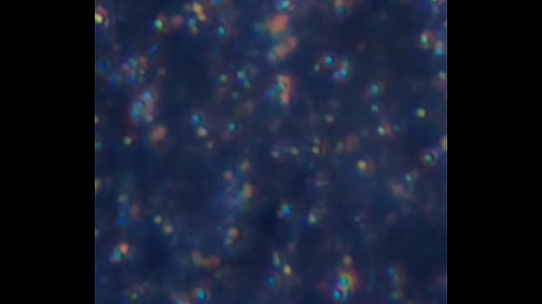 Examen de mis nadadores semen 