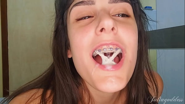 Braces And Blowjob Fantasy - Sucking You With My Elastics On thumbnail
