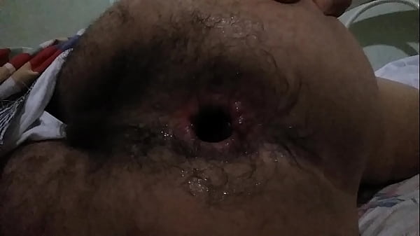 novinho do cu cabeludo 