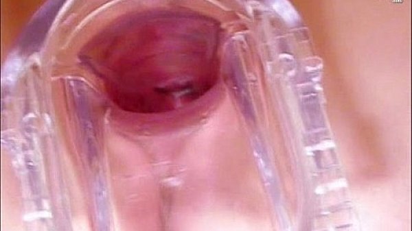 Blonde Petra visiting her gyno doctor for pussy speculum 