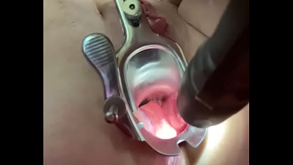 Anal speculum 