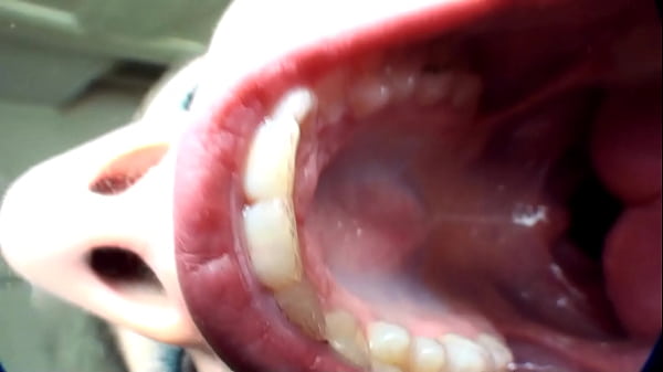 Tongueart Model Shows Her Open Mouth And Long Tongue thumbnail