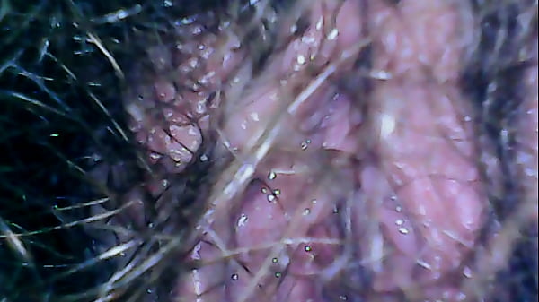 Hairy Exploration Peeing With Endoscope On The Toilet thumbnail