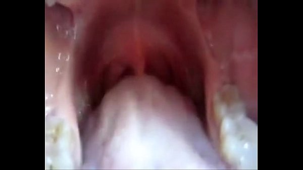 The_inside of the mouth