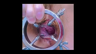 Urethraplay Is So Fan-like!catheter Masturbation And Urethral Sounding Are My Favorites! thumbnail