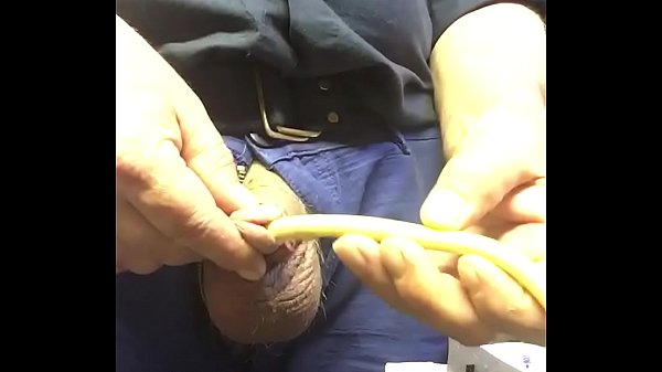 Play MP4 - 30fr catheter I