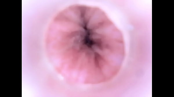 Camera in urethra