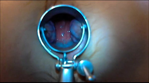 Play MP4 - speculum play 8 min