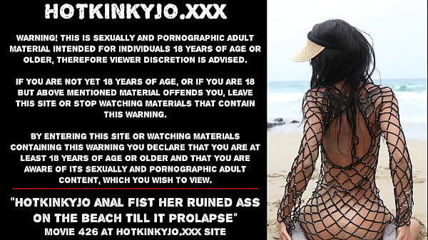 Hotkinkyjo analfist her ruinedass on_the beach till it prolapse