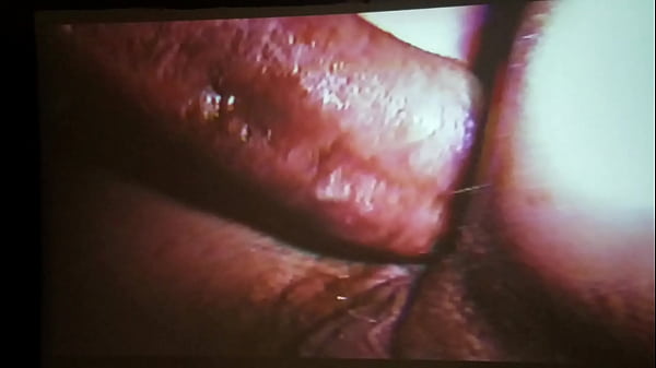 Hairy butthole_spread open