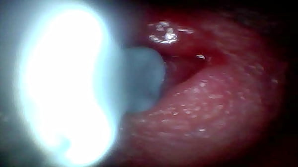 Play MP4 - Endoscope camera captures moment of male ejaculation