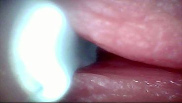Nonton Endoscope Camera Captures Moment Of Male Ejaculation thumbnail