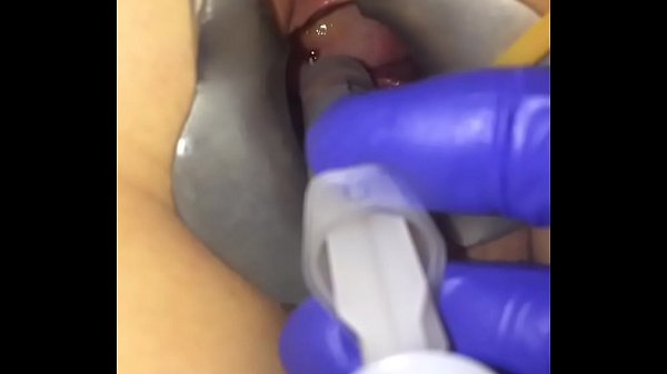 Girl is dangerously t. in gyno office 