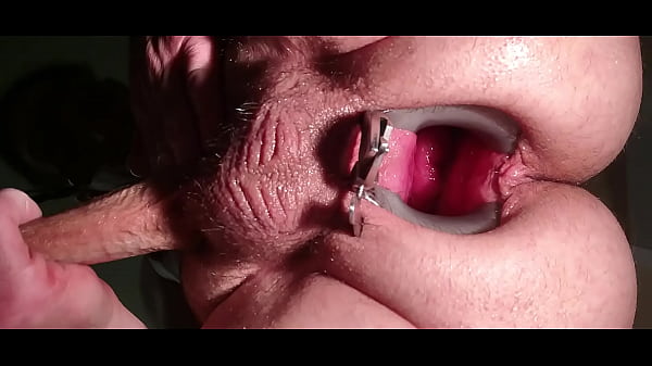 Play MP4 - Speculum spread