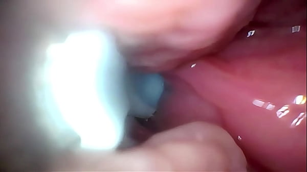 Nonton Semen In Cervix Wide Stretching Pussy Endoscope! thumbnail