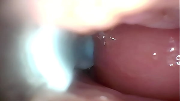 Semen in cervix wide stretching pussy endoscope 