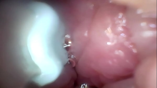 Semen in cervix wide stretching pussy endoscope